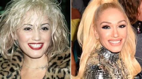 Did Gwen Stefani Get Plastic Surgery? Exploring the Rumors and Realities