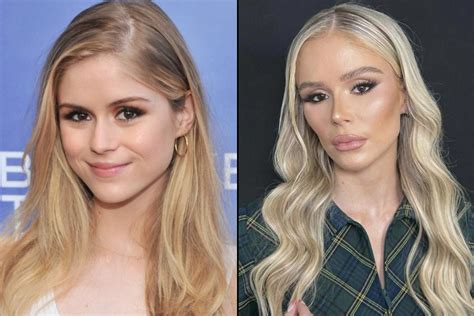 Why Did Erin Moriarty Get Plastic Surgery? Exploring the Intersection of Celebrity and Personal Choice